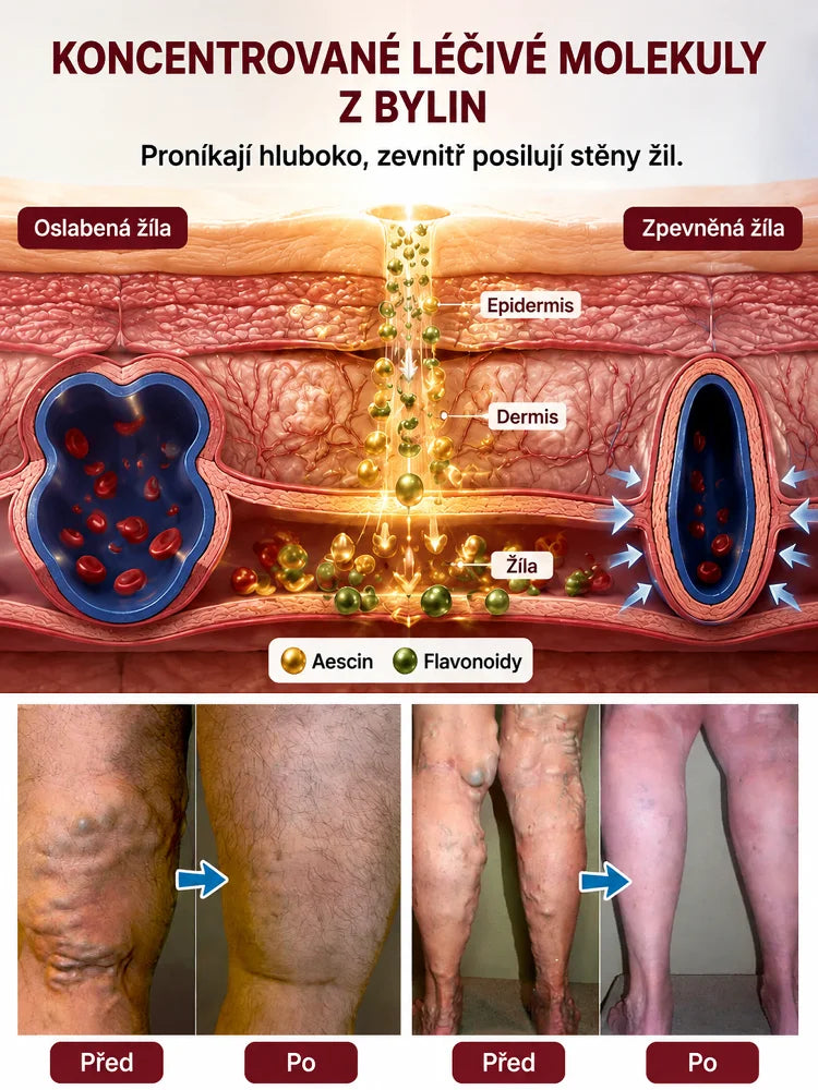 Zklidňující krém na nohy s křečovými žilami