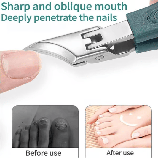 🔥Kleštičky na nehty doporučené podiatry 🛡️ - Ergonomický zkosený design pro nehty na nohou a zarostlé nehty